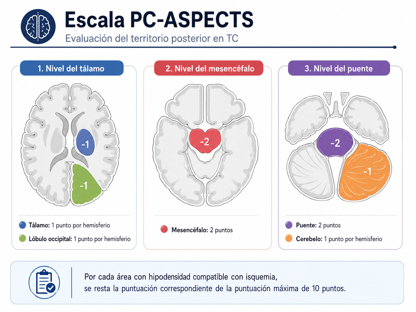 Guía de Escala PC-ASPECTS